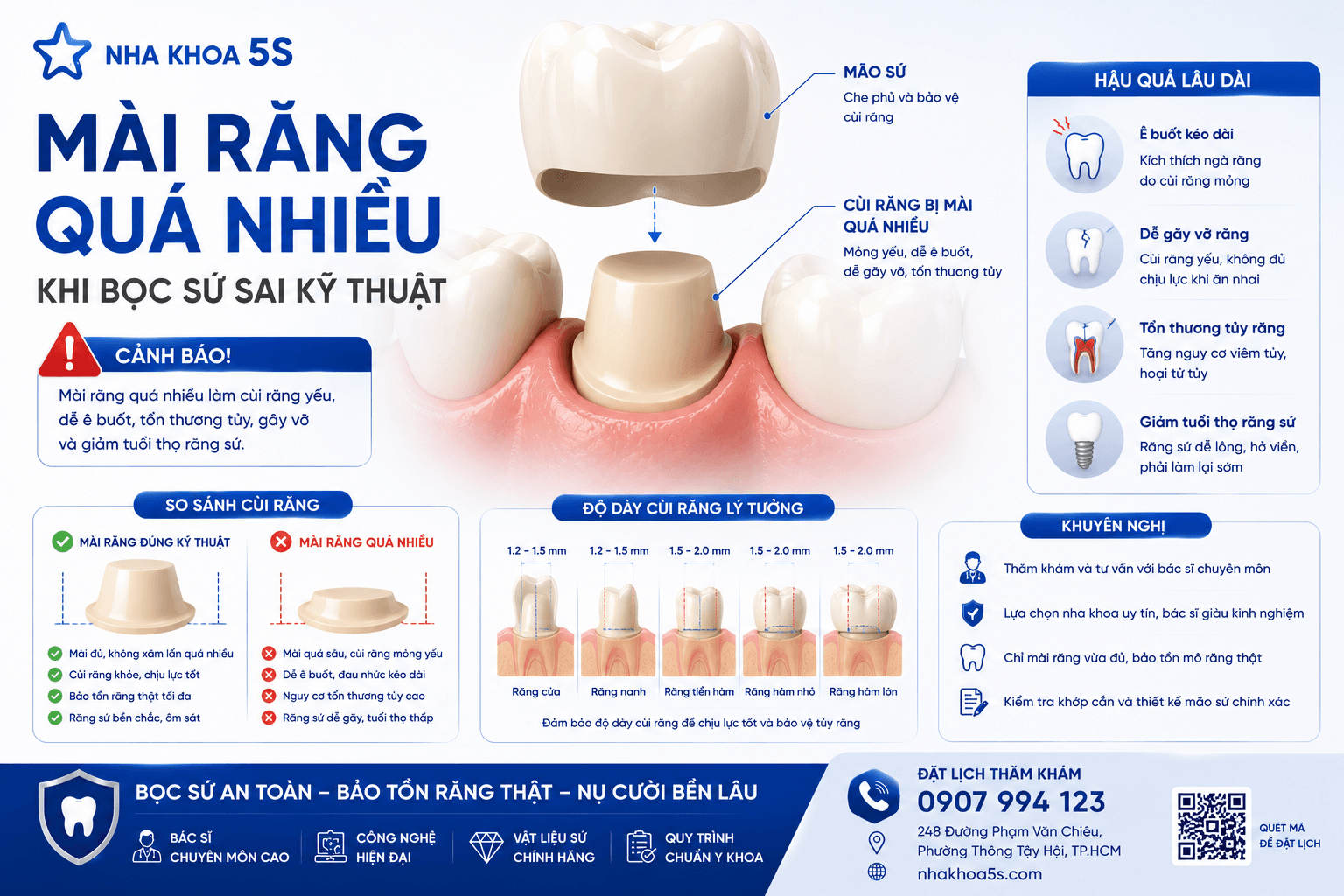Bọc Sứ Sai Kỹ Thuật: 7Dấu Hiệu Cảnh Báo &Amp;Cách Khắc Phục 2026 Chatgpt Image 13 49 29 3 Thg 6 2026 4