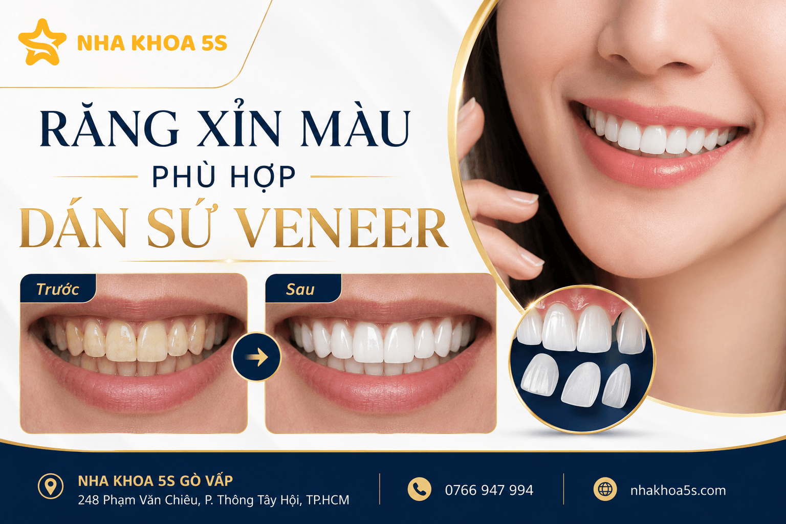 Ai Phù Hợp Dán Sứ Veneer? Tìm Hiểu Các Trường Hợp Răng Xỉn Màu, Thưa Nhẹ, Mẻ Nhỏ, Răng Nhỏ, Lệch Nhẹ Và Người Muốn Bảo Tồn Răng Thật Khi Làm Veneer