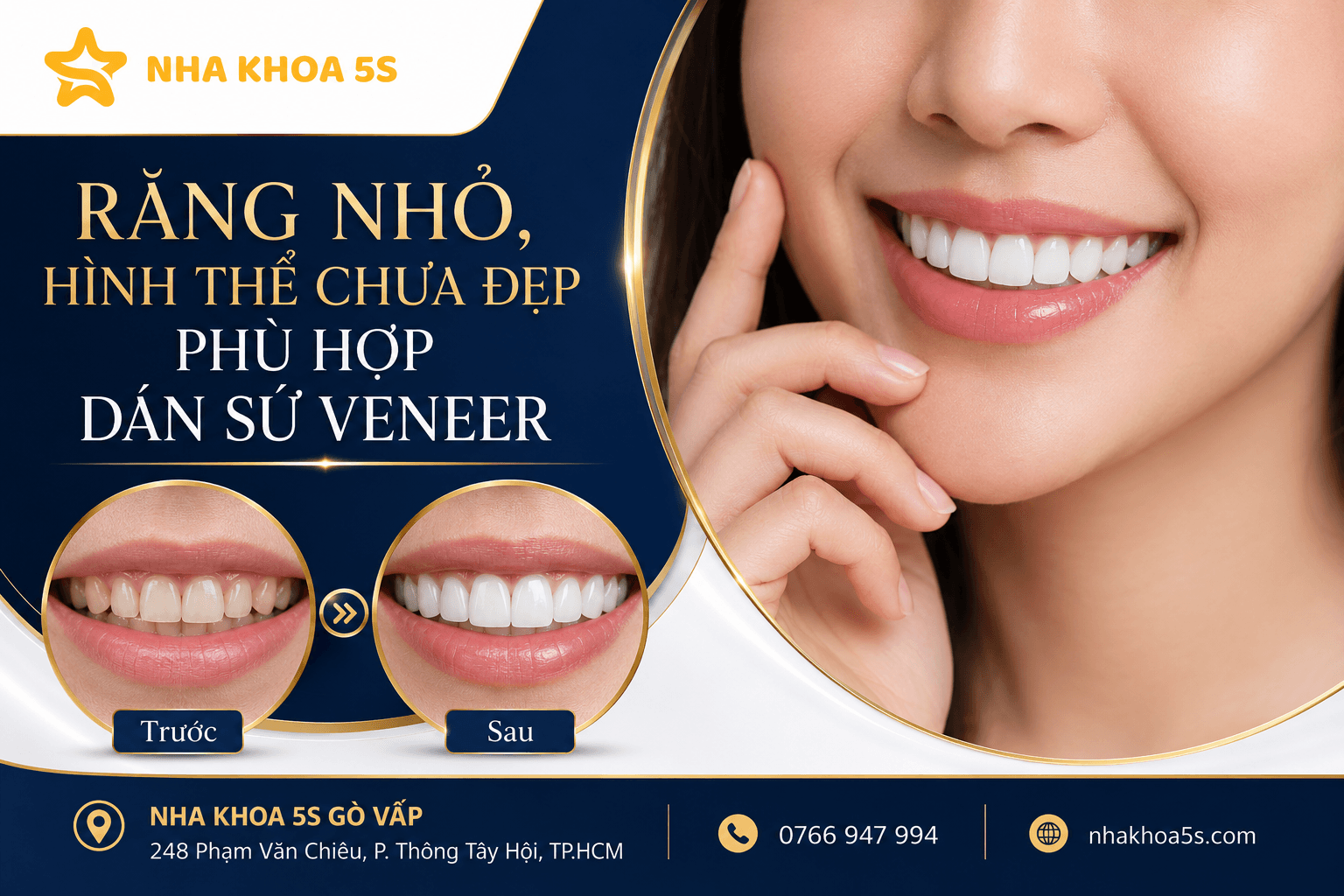 Ai Phù Hợp Dán Sứ Veneer? Tìm Hiểu Các Trường Hợp Răng Xỉn Màu, Thưa Nhẹ, Mẻ Nhỏ, Răng Nhỏ, Lệch Nhẹ Và Người Muốn Bảo Tồn Răng Thật Khi Làm Veneer