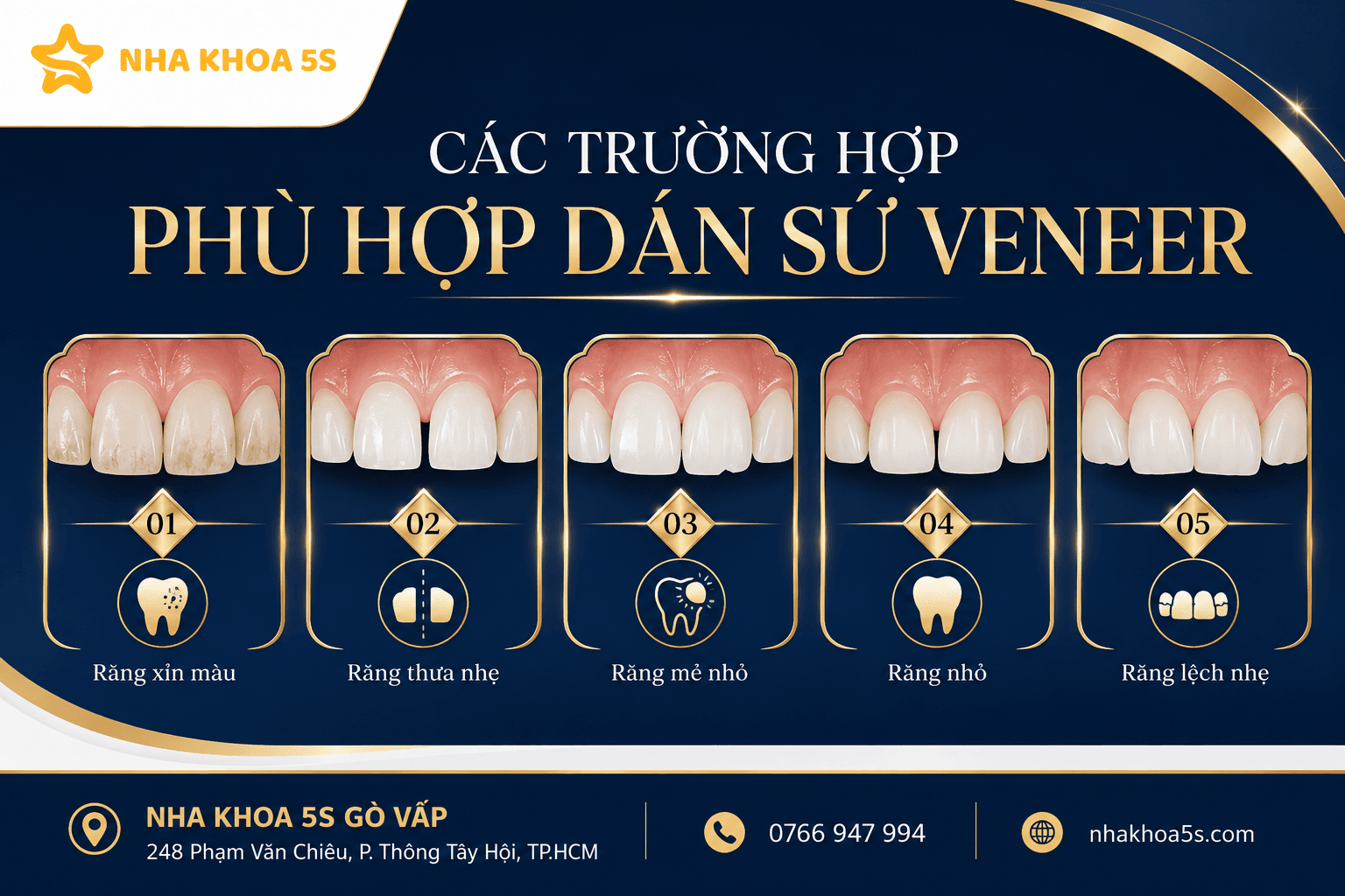 Ai Phù Hợp Dán Sứ Veneer? Tìm Hiểu Các Trường Hợp Răng Xỉn Màu, Thưa Nhẹ, Mẻ Nhỏ, Răng Nhỏ, Lệch Nhẹ Và Người Muốn Bảo Tồn Răng Thật Khi Làm Veneer