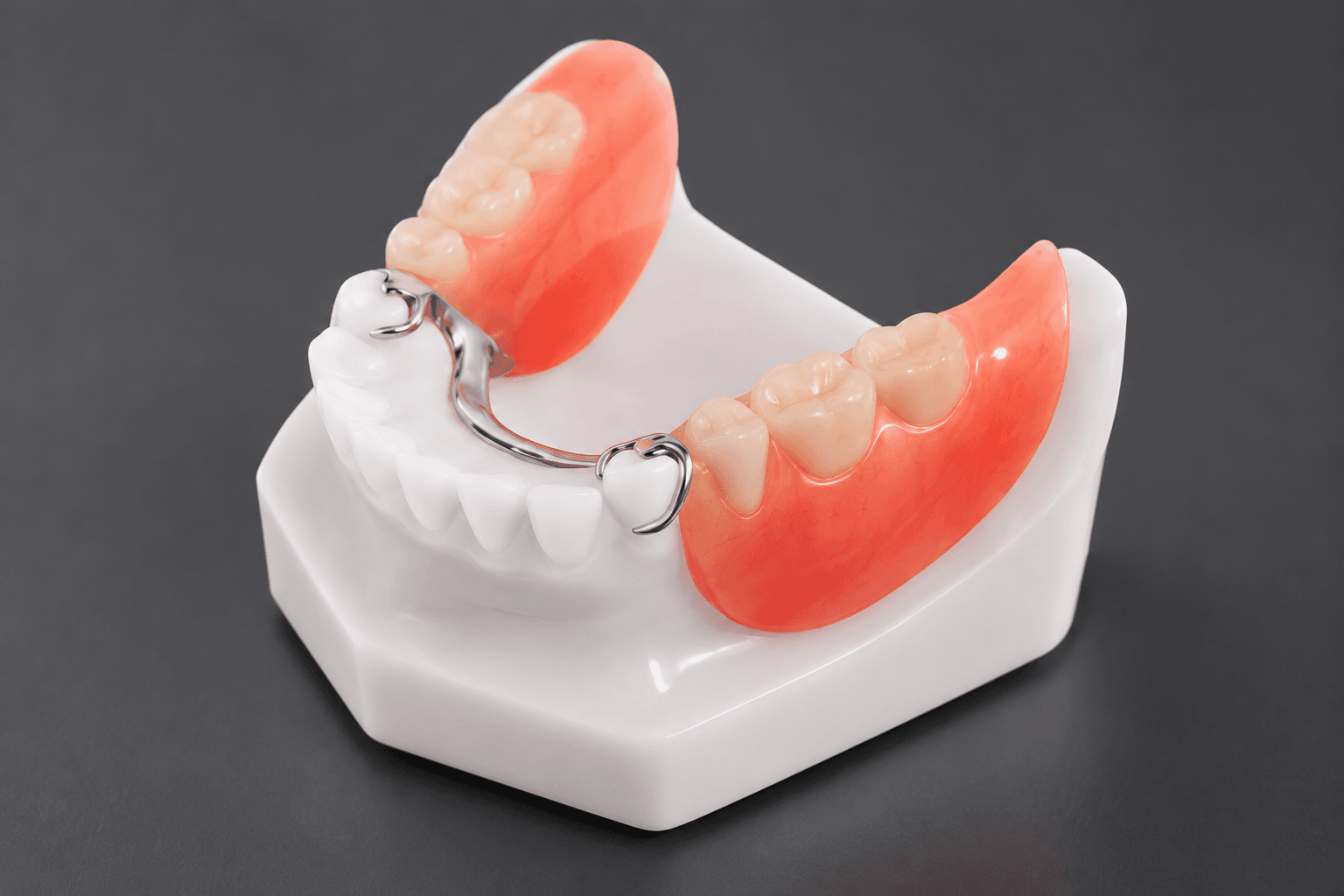 Phục Hình Tháo Lắp – Cải Thiện Thẩm Mỹ Nụ Cười Phục Hình Tháo Lắp Bằng Khung Kim Loại