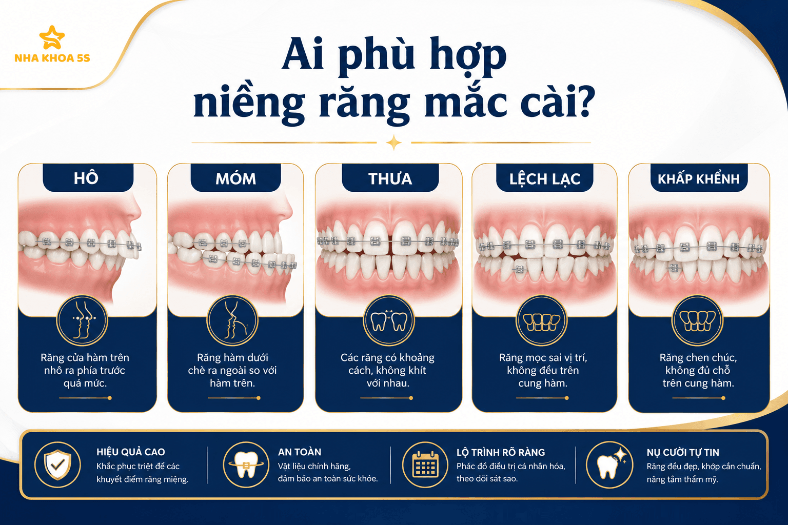 Bảng Giá Niềng Răng Cho Người Lớn Mới Nhất 2026 – Chi Phí Bao Nhiêu? Nên Chọn Phương Pháp Nào?