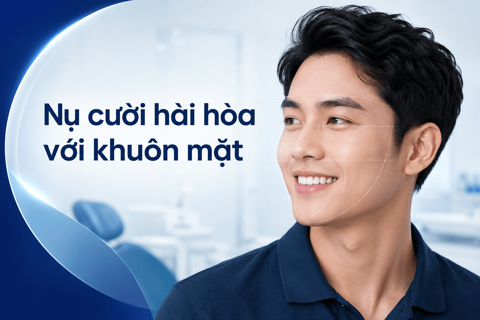 Veneer Thẩm Mỹ Tự Nhiên