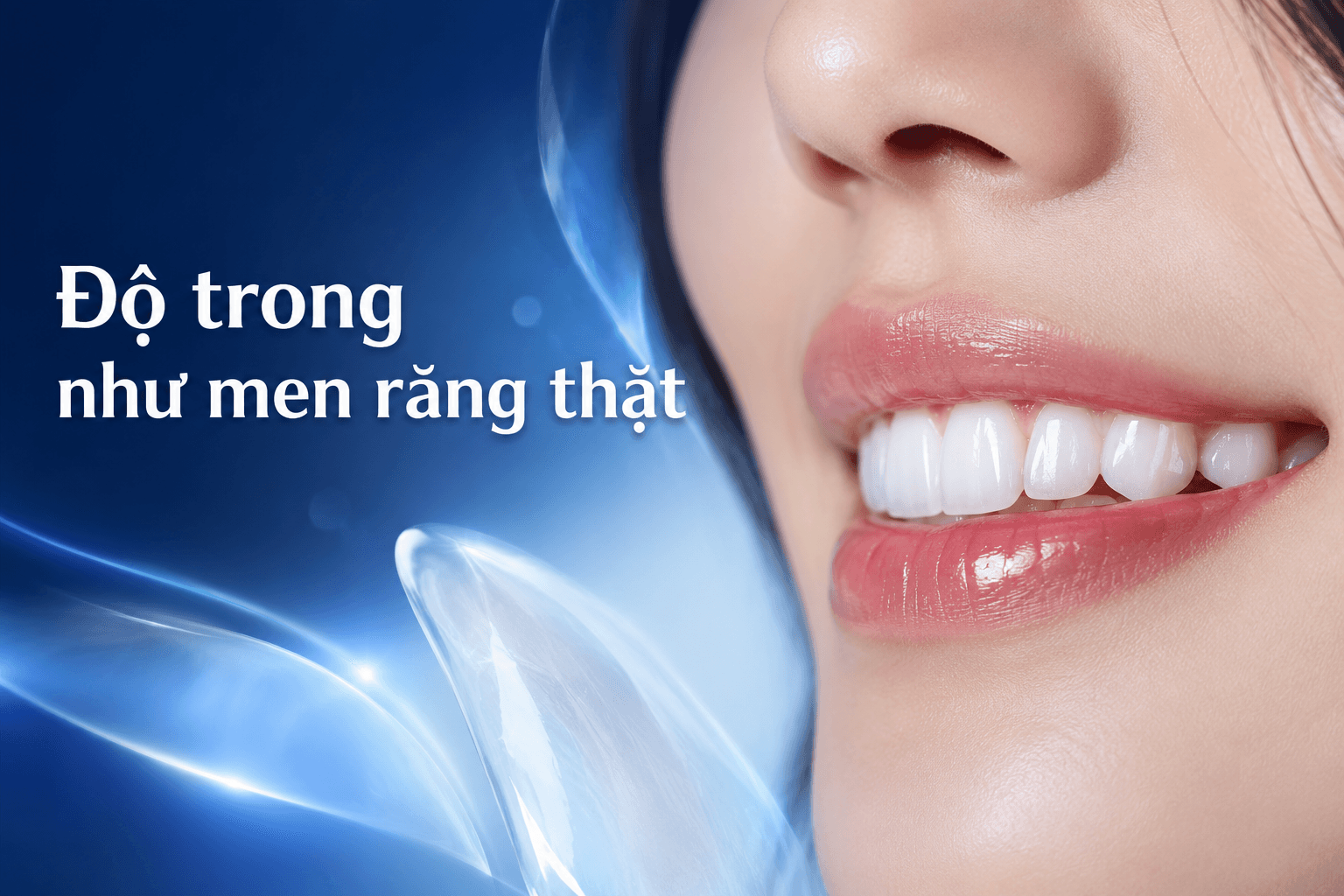 Veneer Thẩm Mỹ Tự Nhiên
