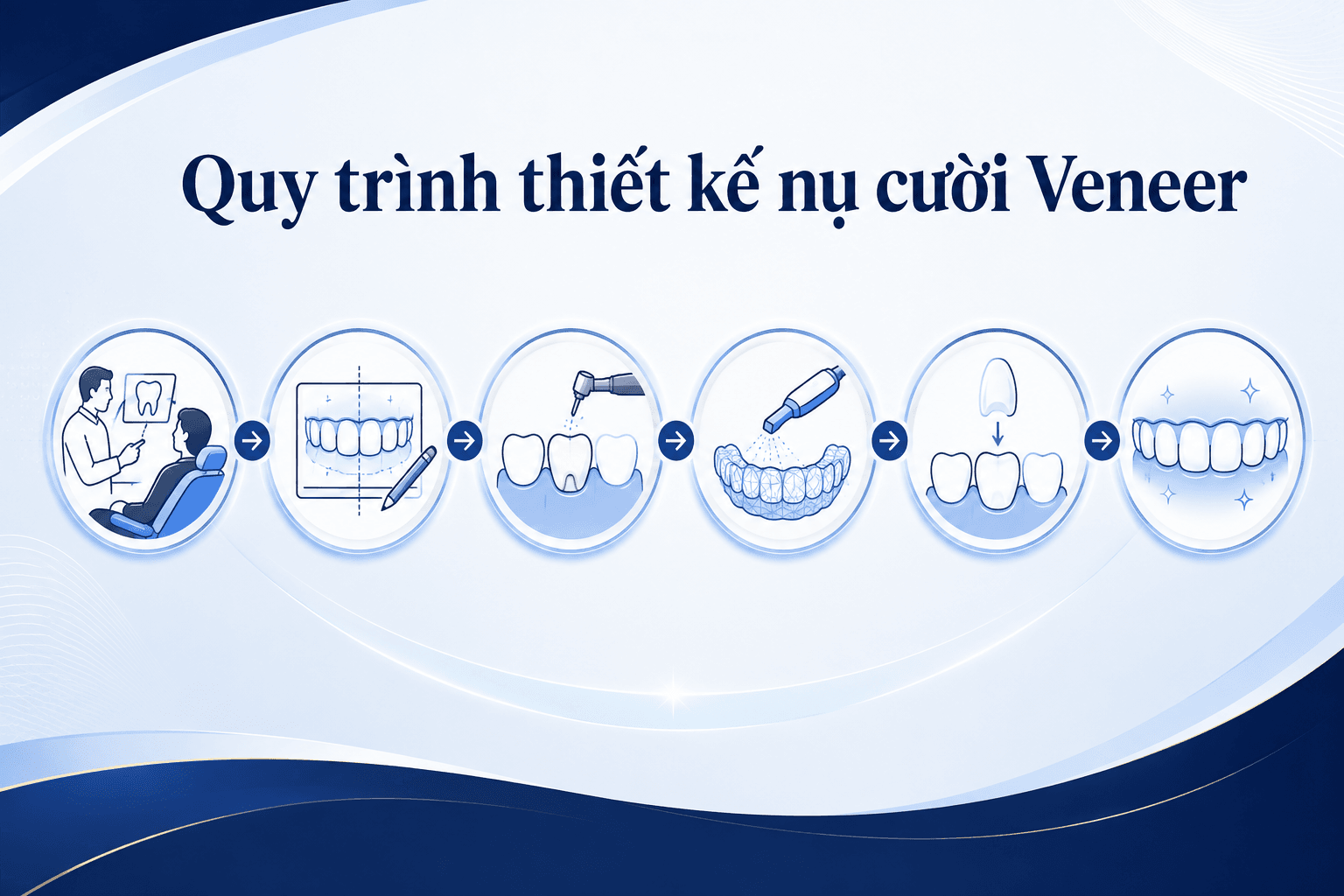 Veneer Thẩm Mỹ Tự Nhiên