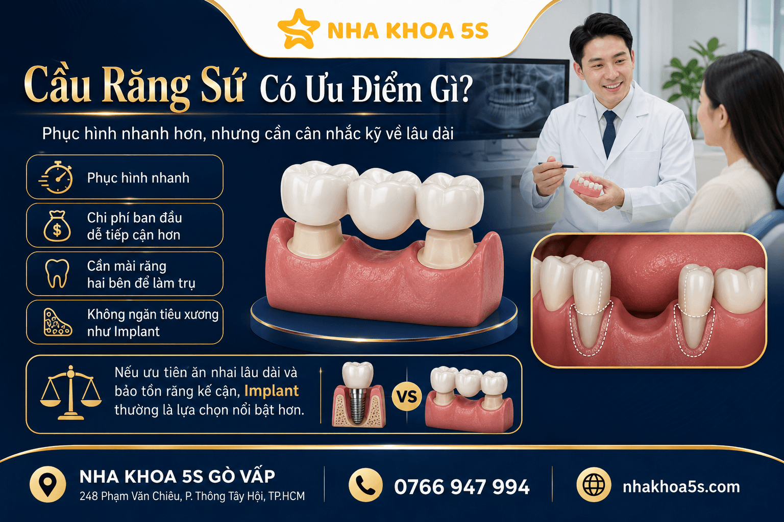 Implant Vs Cầu Răng Sứ