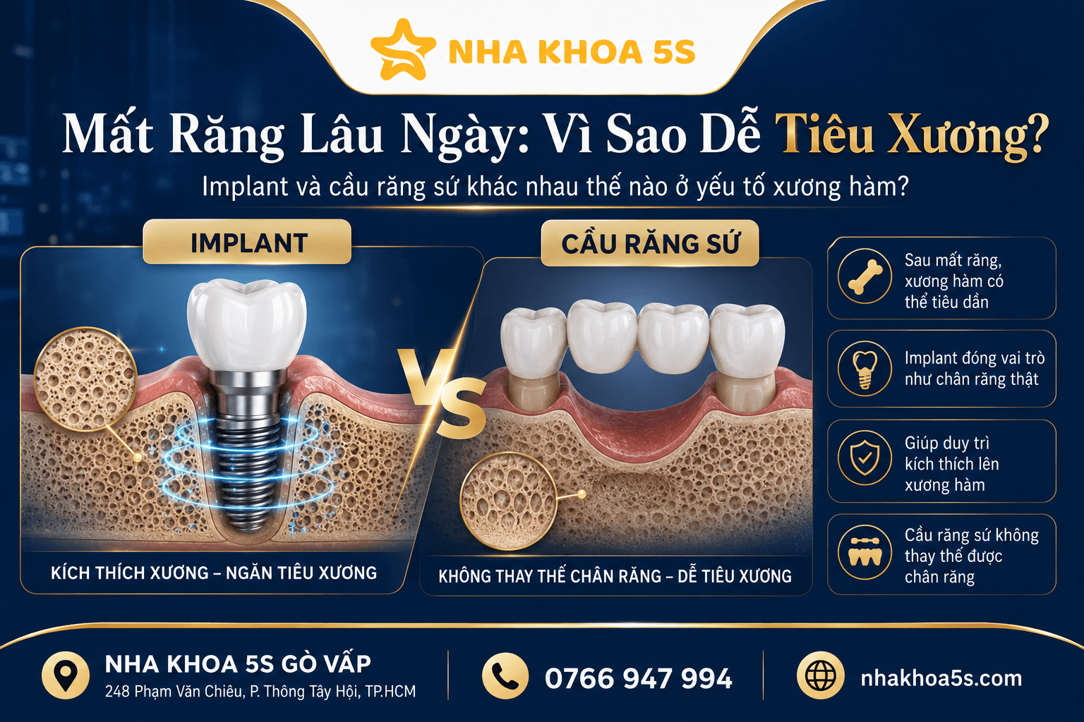 Implant Vs Cầu Răng Sứ