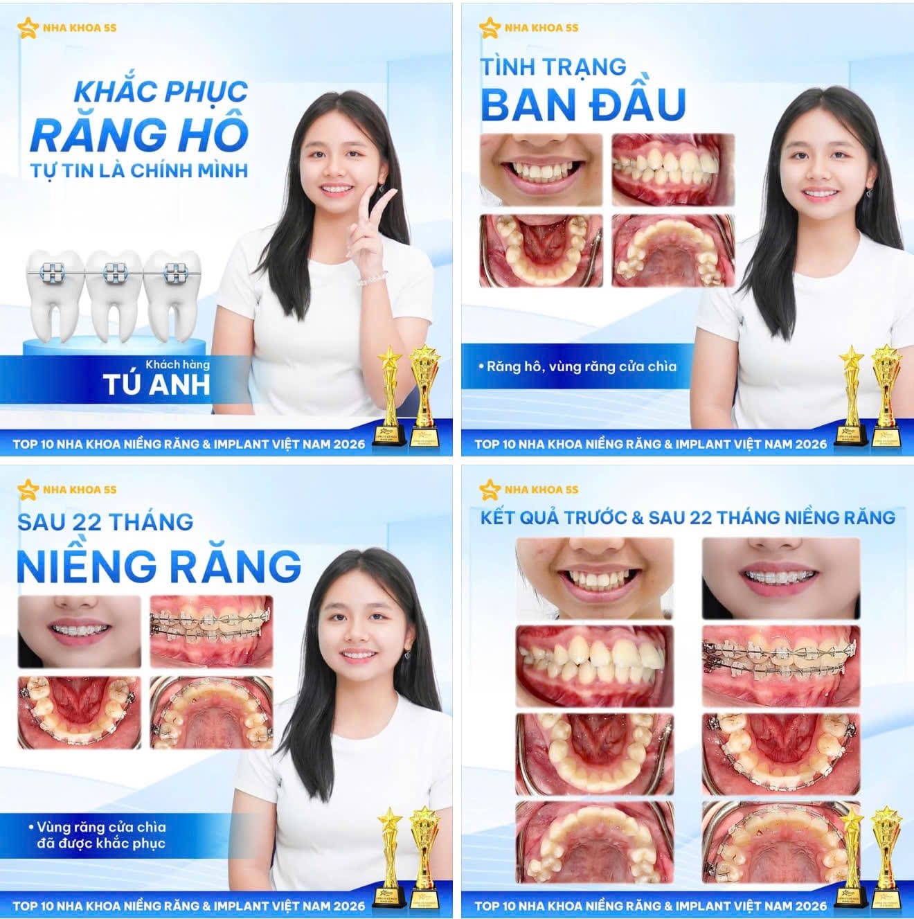 Nha Khoa 5S | Nha Khoa Gò Vấp, Hồ Chí Minh Z7887570462475 Ac6326061Cd6Ba7F62C3B88Ab526Acd3 2