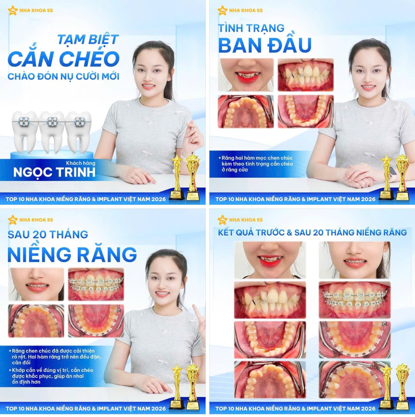 Nha Khoa 5S | Nha Khoa Gò Vấp, Hồ Chí Minh Z7887570476967 F605Ebcef2Ea0F8E3384A3C7807Bb8E5 2