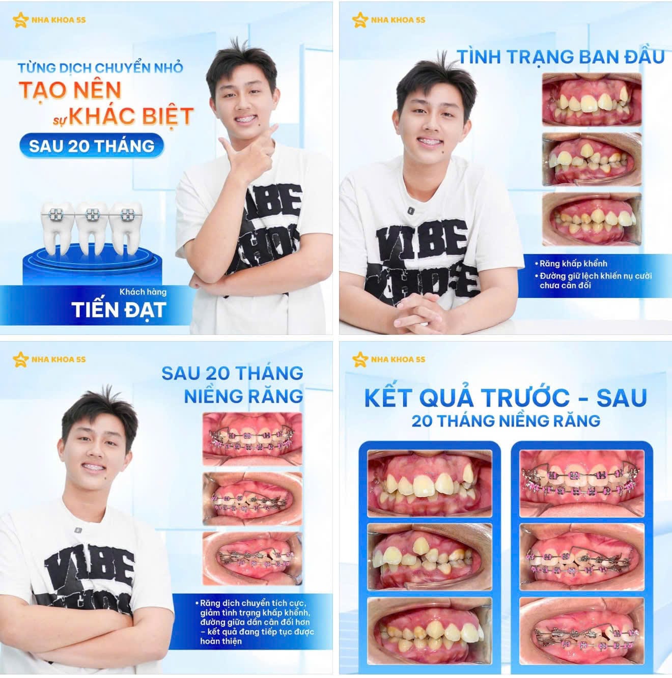 Nha Khoa 5S | Nha Khoa Gò Vấp, Hồ Chí Minh Z7887570487337 8Cbed6Fa9B2Bb094A1B6E368E340Ae9D 2