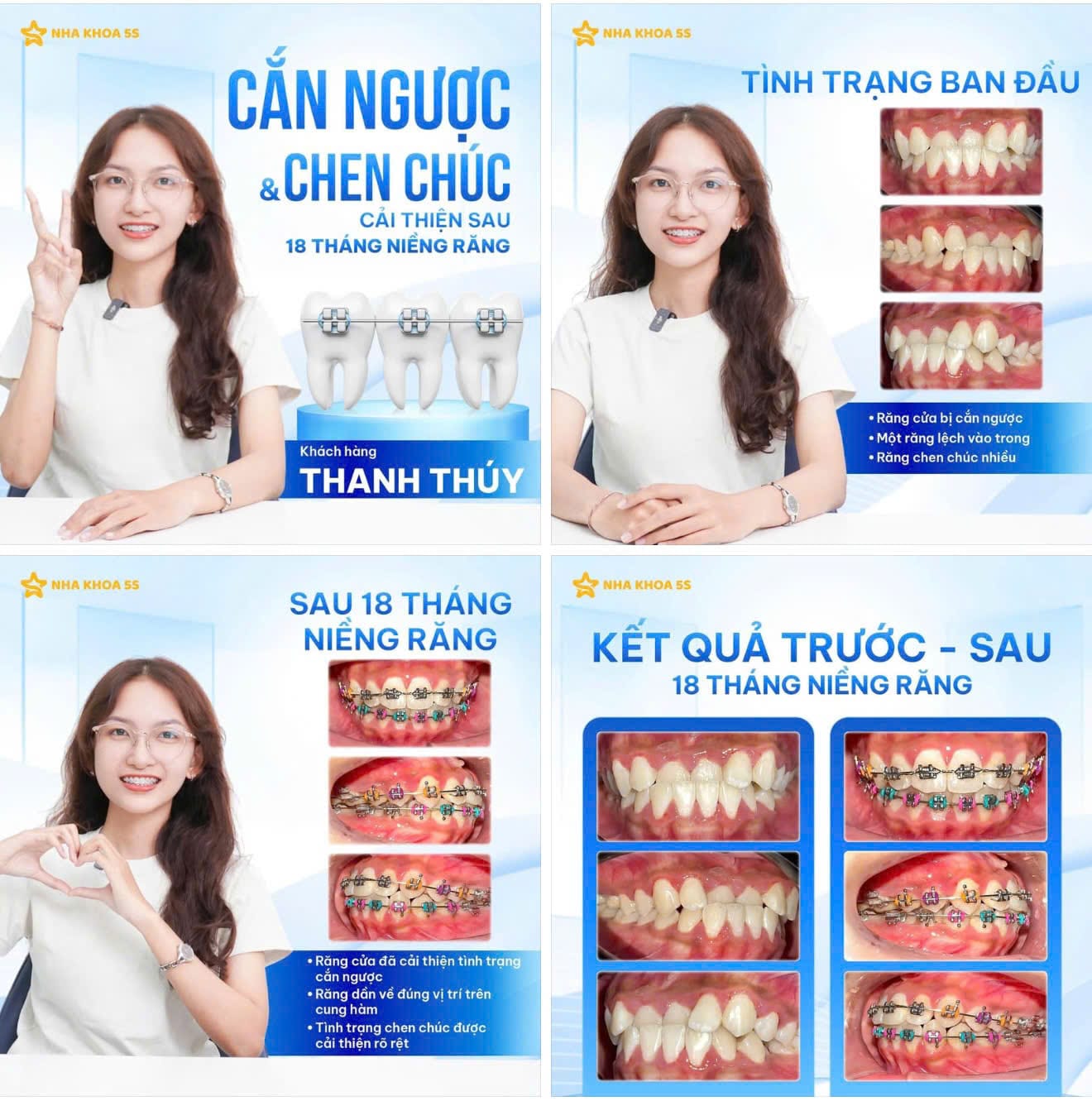 Nha Khoa 5S | Nha Khoa Gò Vấp, Hồ Chí Minh Z7887570501447 C8F1E866220B3196E0C2007844679C09 2