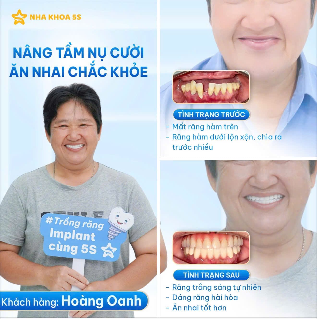 Nha Khoa 5S | Nha Khoa Gò Vấp, Hồ Chí Minh Z7995468553187 0Df41E2804145848Ea734Be81588Da27 2