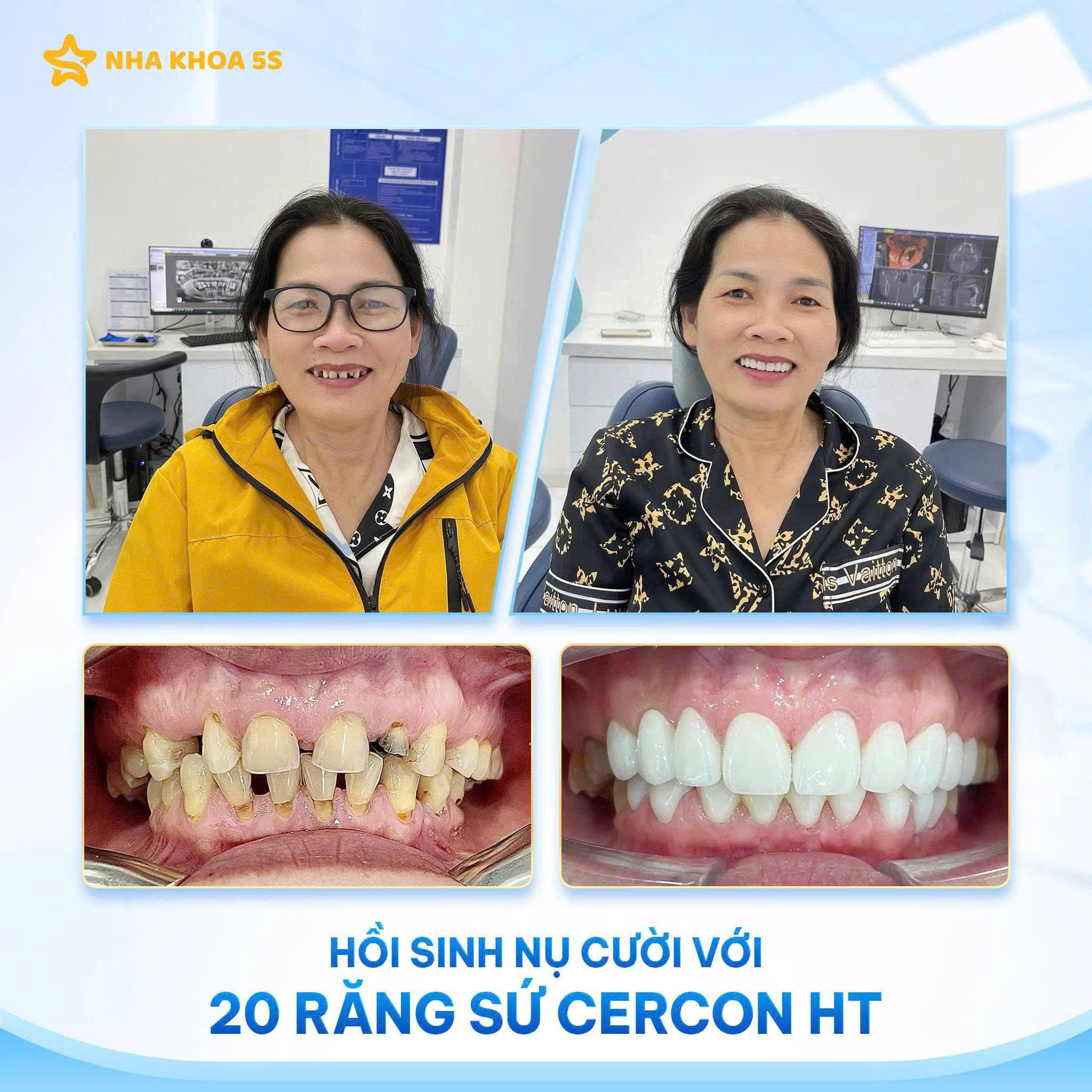 Nha Khoa 5S | Nha Khoa Gò Vấp, Hồ Chí Minh Z7995468582028 F21B9Cd7F39Bd9655649C7C45F48D7C4 2
